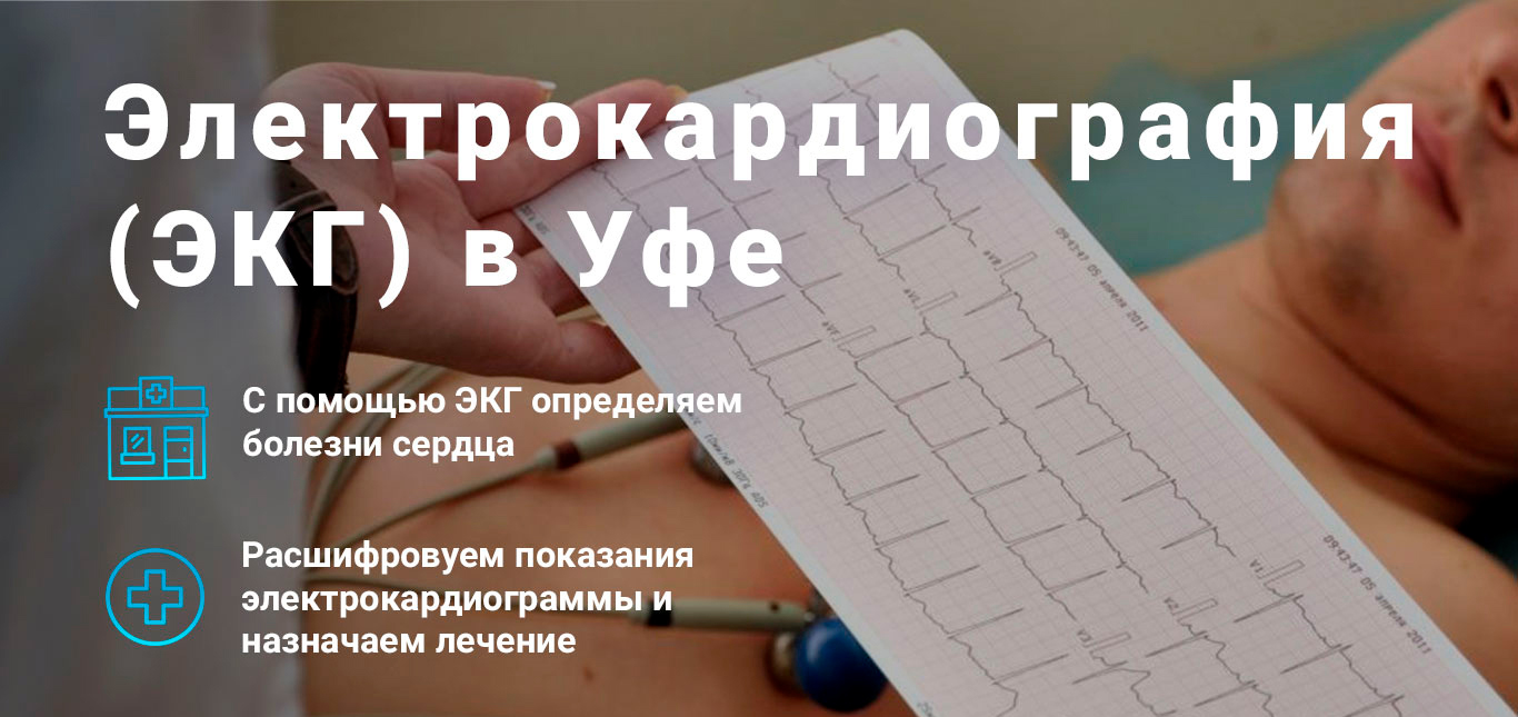 ЭКГ
