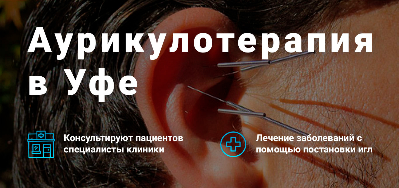 Аурикулотерапия
